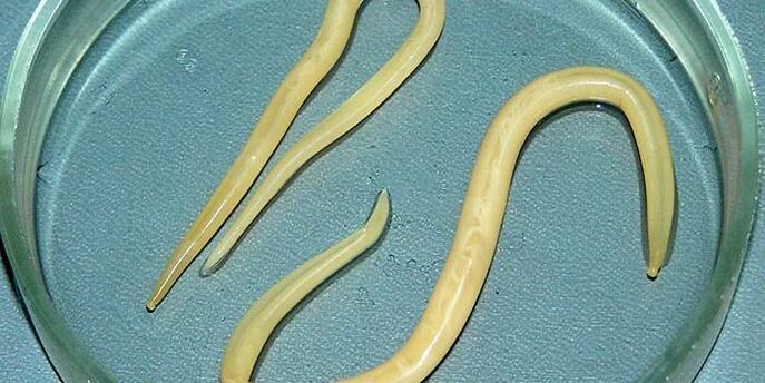 Human roundworms in a Petri dish - parasitize the walls of the small intestine