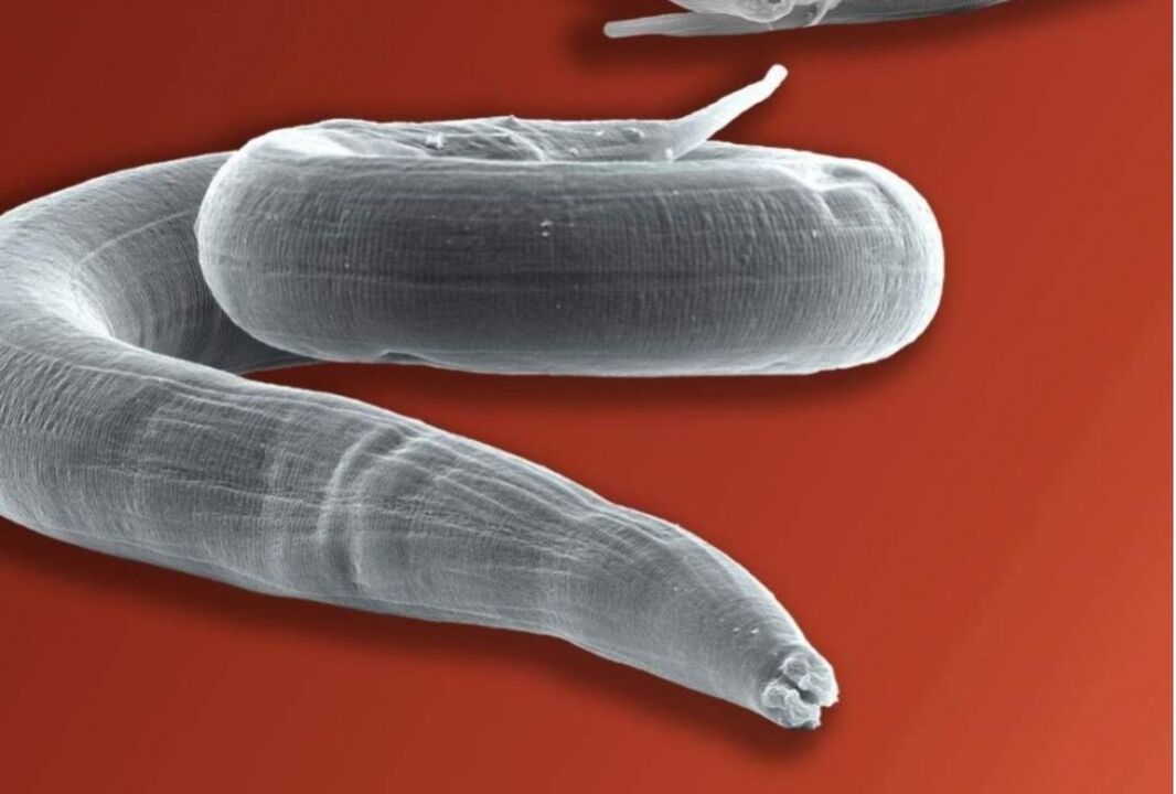 human body pinworm
