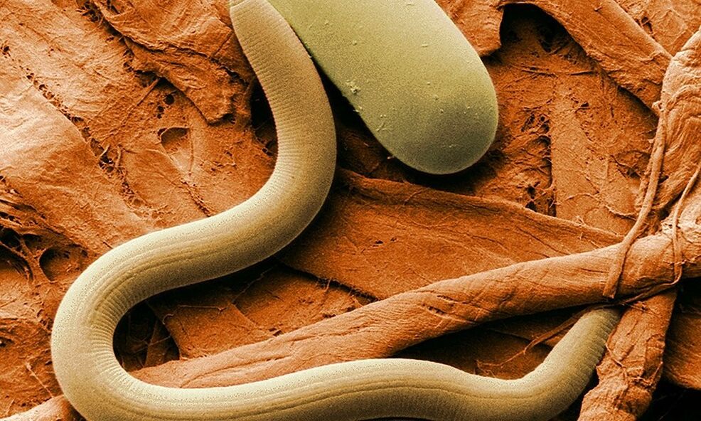parasitic worm of the human body