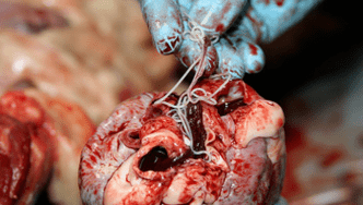 Helminthes in the heart