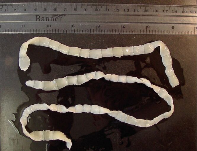 Large tapeworm